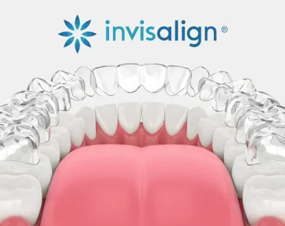 Clear Aligners in Montgomery, AL, Clear Aligners near me
